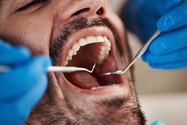 Best Emergency Dental Filling Replacement  in Woodlake, CA